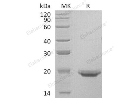 Recombinant Human Interleukin-17F/IL-17F Protein (His Tag)(Active)