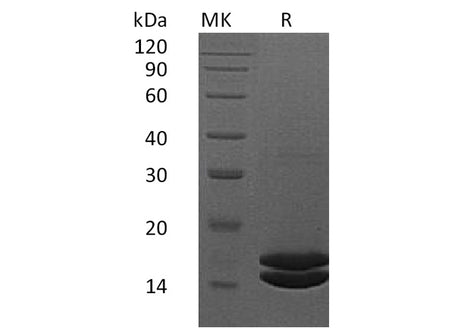 Recombinant Human Interleukin-2/IL-2 Protein (His Tag)(Active)