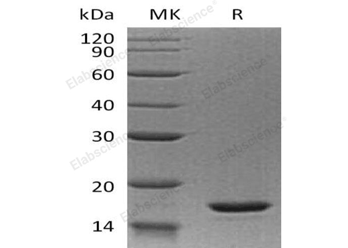 Recombinant Human Interleukin-20/IL-20 Protein