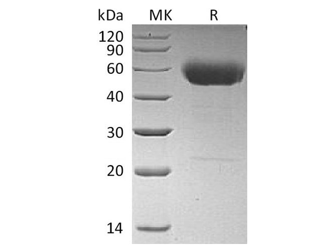 Recombinant Human Interleukin-22/IL-22 Protein (C-hIgG2 Fc)(Active)
