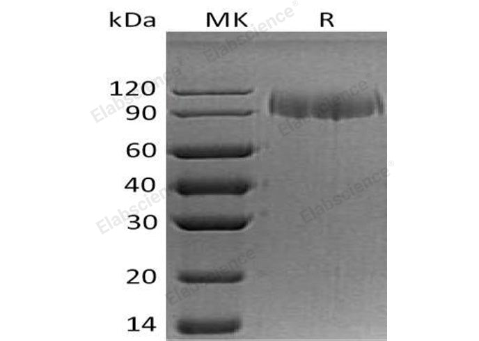 Recombinant Human ITGA5 Protein (His Tag)(Active)