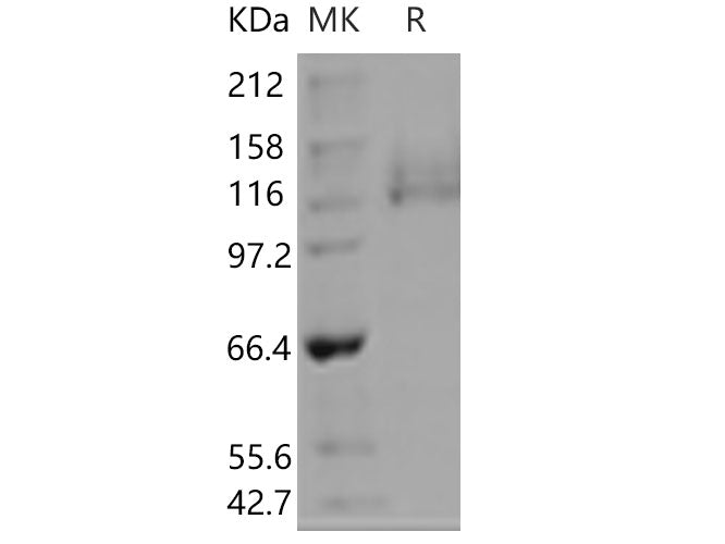Recombinant Human ITGA6 & ITGB1 Heterodimer Protein