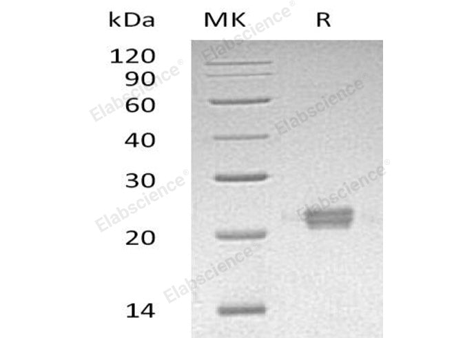 Recombinant Human ITPase/ITPA Protein (His Tag)