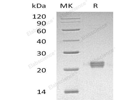 Recombinant Human ITPase/ITPA Protein (His Tag)