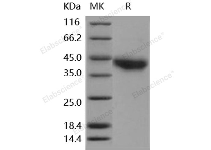 Recombinant Human JAML/AMICA Protein (His Tag)