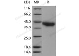 Recombinant Human JAML/AMICA Protein (His Tag)