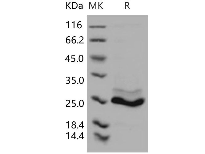 Recombinant Human K-Ras/K-Ras Protein (His Tag)