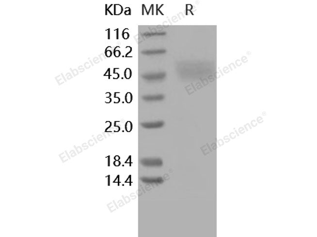 Recombinant Human Kallikrein 1/KLK1 Protein (His Tag)(Active)