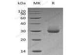 Recombinant Human Kallikrein 4/KLK4 Protein (His Tag)