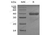 Recombinant Human Kallikrein 5/KLK5 Protein (His Tag)