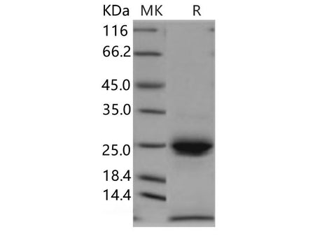 Recombinant Human Kallikrein 6/KLK6 Protein (His Tag)(Active)