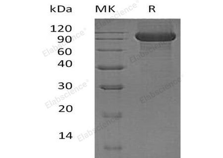 Recombinant Human KEL/CD238 Protein (His Tag)