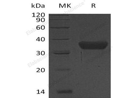 Recombinant Human KLK-8/Kallikrein-8 Protein (His Tag)