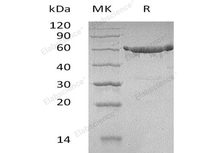 Recombinant Human KPNA2 Protein (His Tag)