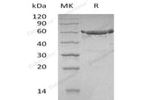 Recombinant Human KPNA2 Protein (His Tag)