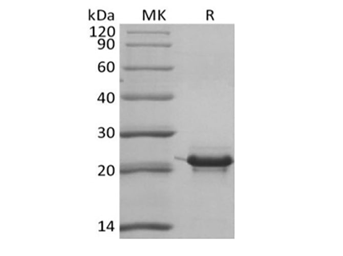Recombinant Human KRAS4B (N-6His)