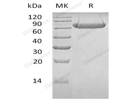 Recombinant Human LAG3/CD223 Protein (Fc Tag)
