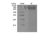 Recombinant Human LAMP1/CD107a Protein (His Tag)