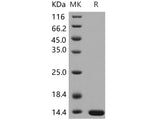 Recombinant Human LAMTOR2/ROBLD3/MAPBPIP Protein (His Tag)