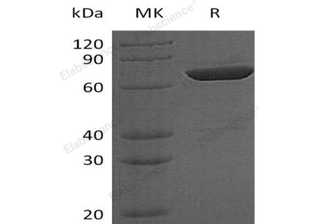 Recombinant Human LCP2 Protein (His Tag, N-T7 Tag)