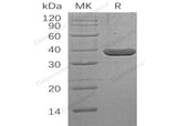 Recombinant Human LDH-A/LDHA Protein (His Tag)