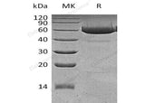 Recombinant Human Legumain/LGMN Protein (His Tag)