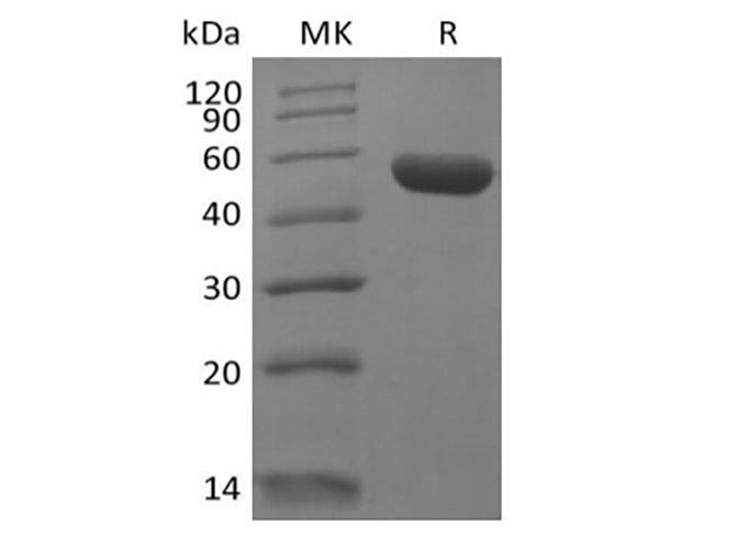 Recombinant Human Leukocyte-associated Immunoglobulin-like Receptor 2/ LAIR2/CD306 (C-Fc)