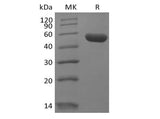 Recombinant Human Leukocyte-associated Immunoglobulin-like Receptor 2/ LAIR2/CD306 (C-Fc)