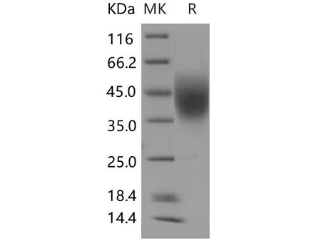 Recombinant Human LFA-3/CD58 Protein (His Tag)