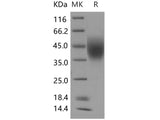 Recombinant Human LFA-3/CD58 Protein (His Tag)