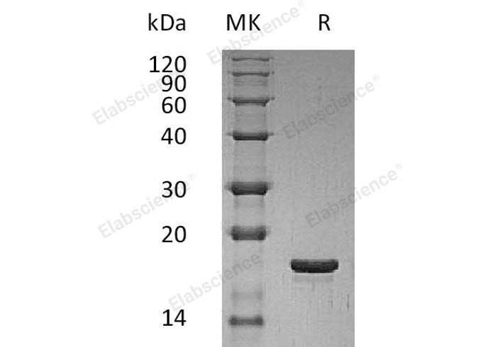 Recombinant Human LIF Protein (E.coli)(Active)