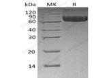 Recombinant Human LILRB2/CD85d Protein (His Tag)