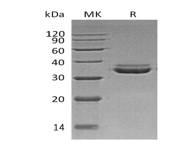 Recombinant Human LMAN2L Protein (His Tag)
