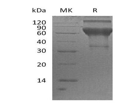 Recombinant Human LMIR2/CD300C Protein (Fc Tag)