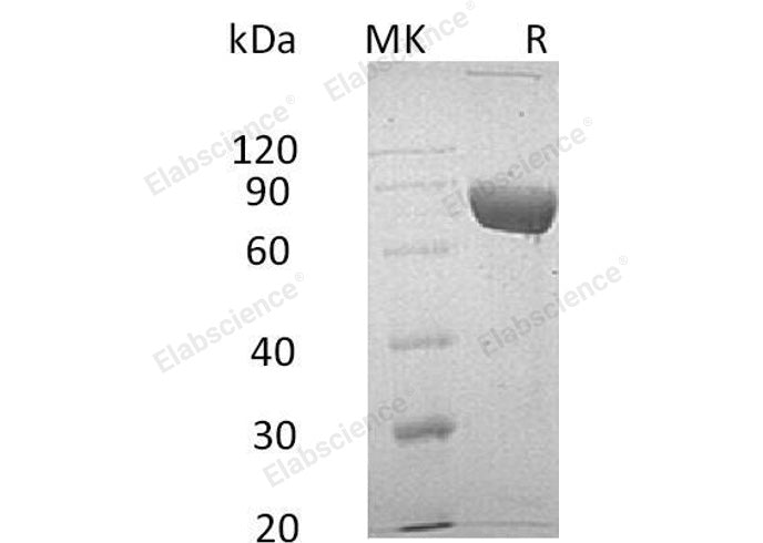Recombinant Human LRG1 Protein (Fc & His Tag)