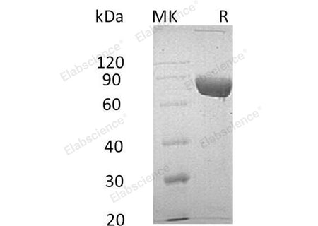 Recombinant Human LRG1 Protein (Fc & His Tag)