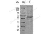 Recombinant Human LRP12 Protein (His Tag) - MSE Supplies LLC