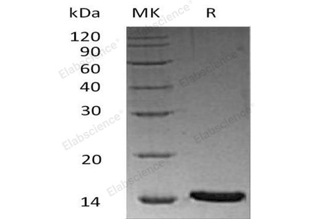 Recombinant Human LRRC3B Protein (His Tag)