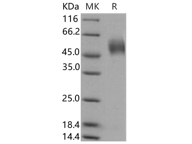 Recombinant Human LSAMP Protein (His Tag)