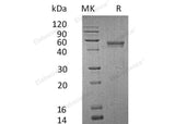 Recombinant Human Lymphotactin/XCL1 Protein (Fc & His Tag)