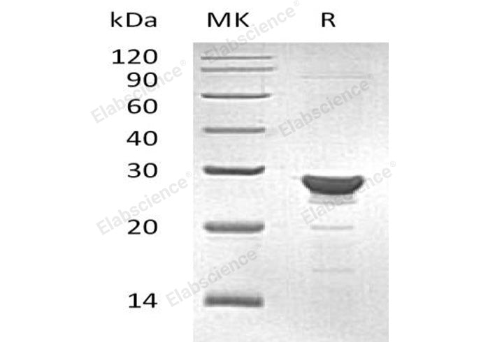 Recombinant Human MAA/GSTZ1 Protein (His Tag)