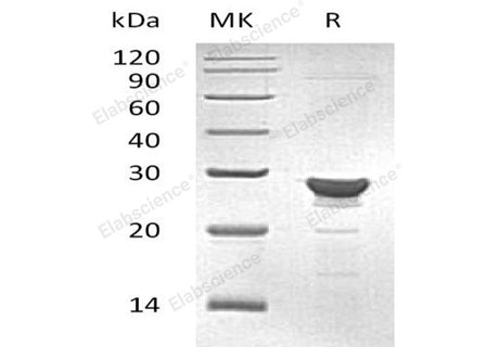 Recombinant Human MAA/GSTZ1 Protein (His Tag)