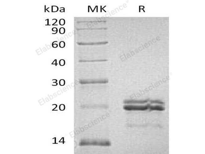 Recombinant Human MAX Protein (His &GST Tag)