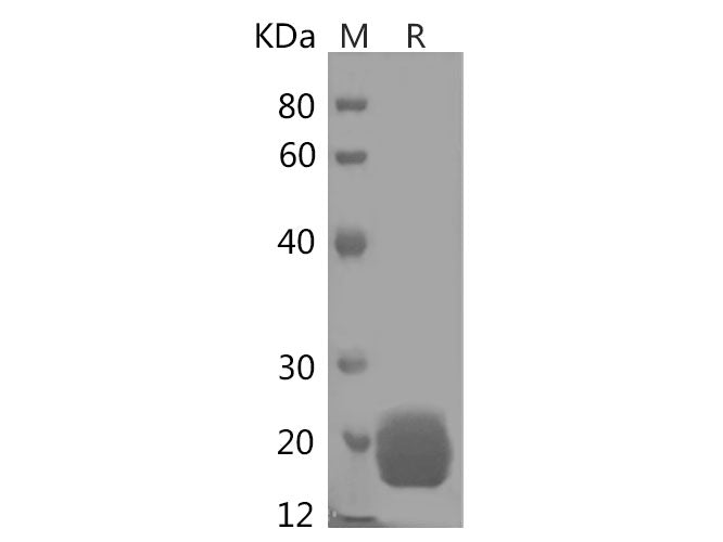Recombinant Human MCEE Protein (His Tag)