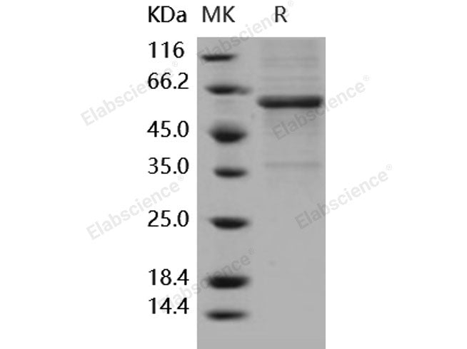 Recombinant Human METAP1 Protein (Fc Tag)