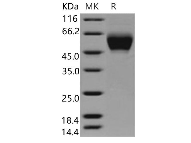 Recombinant Human MICA Protein (His Tag)