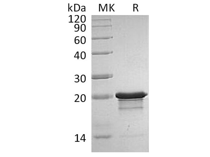 Recombinant Human/Mouse FGF-8b/FGF8B Protein (Active)
