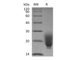 Recombinant Human/Mouse/Rat Irisin/FNDC5 (N-6His) Purity >95%