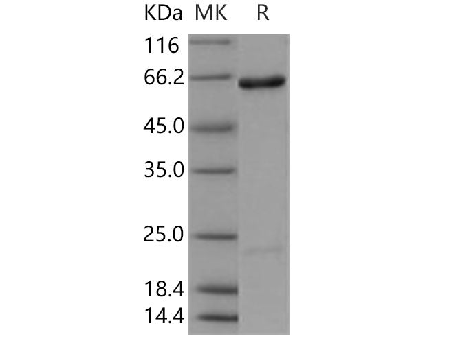 Recombinant Human/Mouse USP46 Protein (SUMO Tag)
