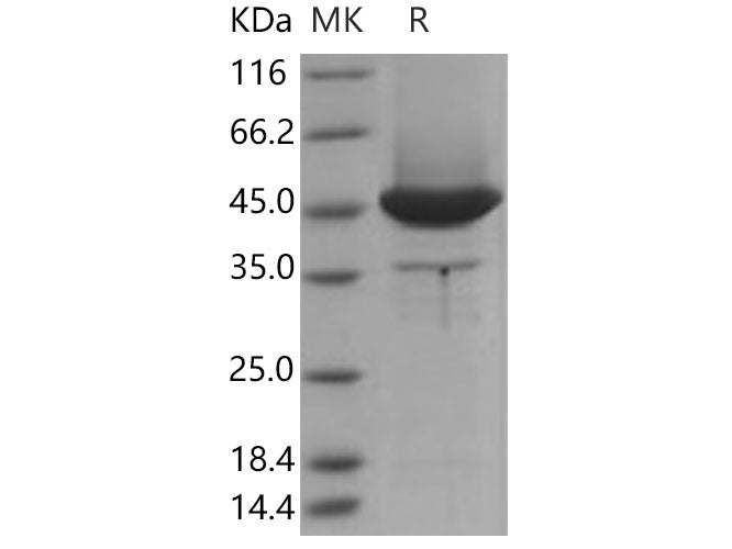 Recombinant Human MSN/Moesin Protein (aa 1-346, His Tag)